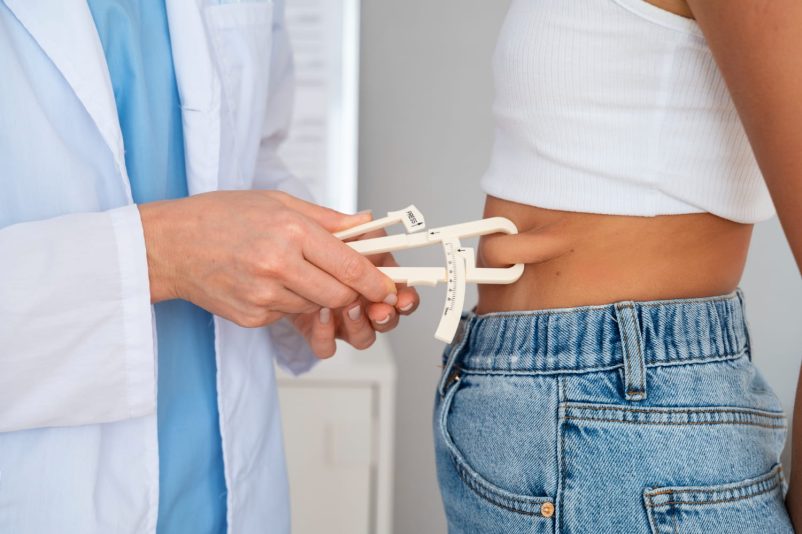 revision weight loss surgery on the Gold Coast